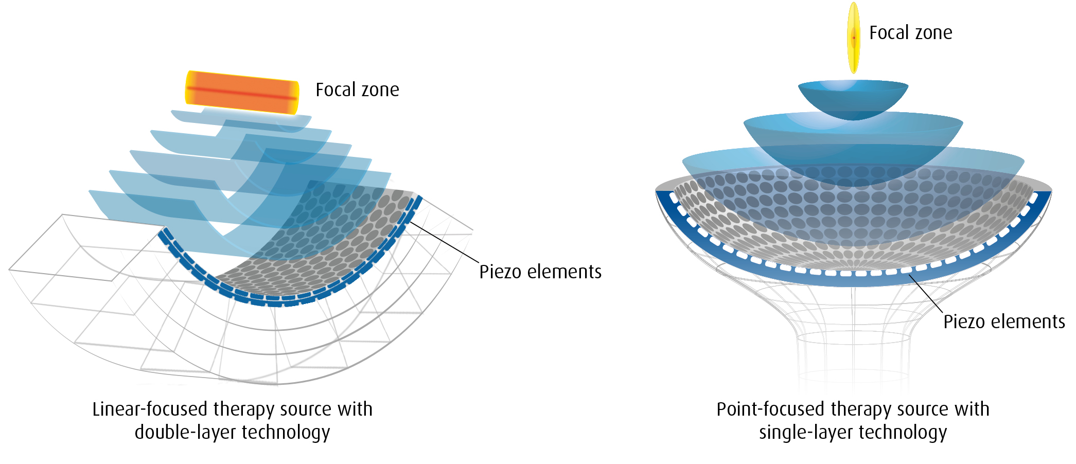 The technology behind extracorporeal shockwave therapy shockwave